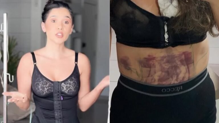 Cenapop · Gizelly Bicalho diz que fez plástica escondido e teve complicações: “Peito aberto”